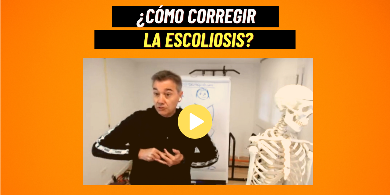 ¿Cuál es el origen de la escoliosis (Miniatura – YouTube) (1)