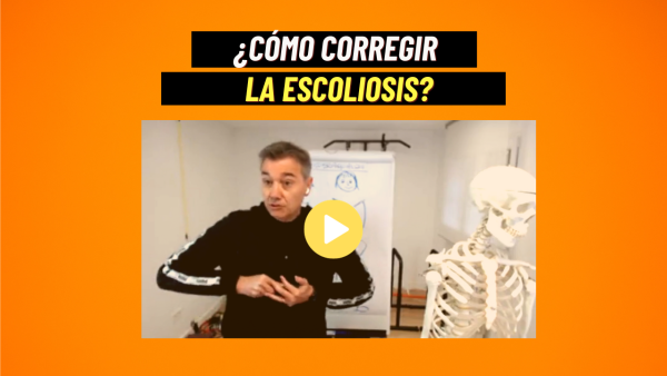 ¿Cuál es el origen de la escoliosis (Miniatura – YouTube) (1)